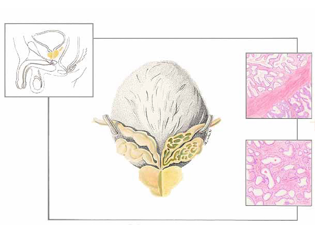 Tessuto Cellulare delle Vescichette Seminali e della Prostata